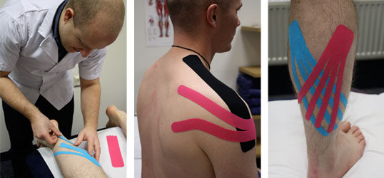 Kinesio tape in Nottingham