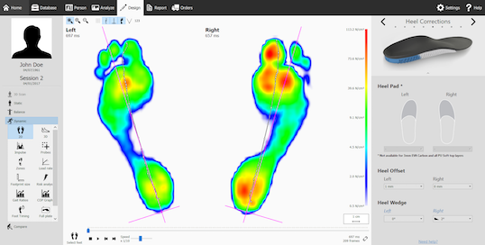 orthotics Phits system